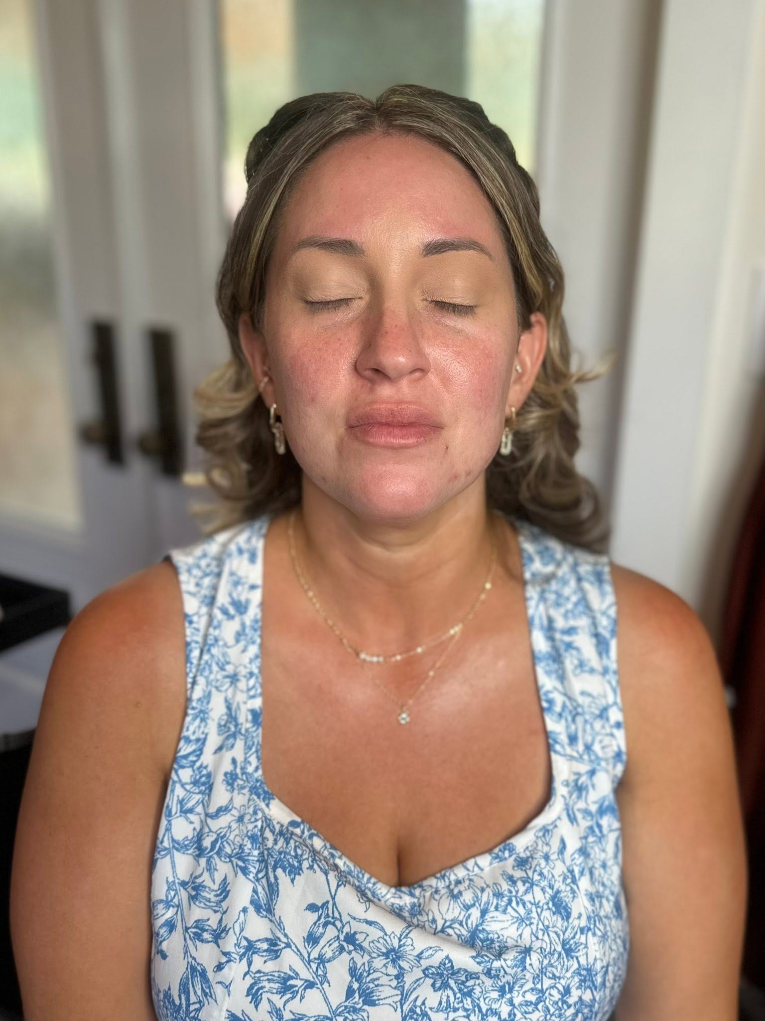 Fresh Raw Face Before Makeup